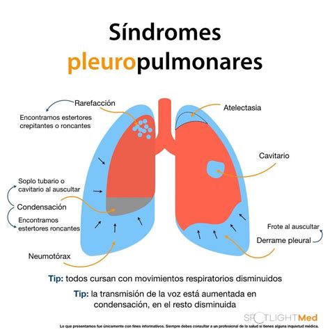 sindrome pleuropulmonar-4